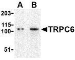 TRPC6 Antibody - BSA Free, Novus Biologicals 0.025 mg, Unconjugated:Antibodies,