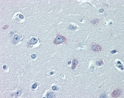TRPM2 Antibody, Novus Biologicals 0.05mg; Unlabeled:Antibodies, Polyclonal