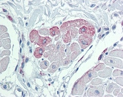TRPM2 Antibody, Novus Biologicals 0.05mg; Unlabeled:Antibodies, Polyclonal
