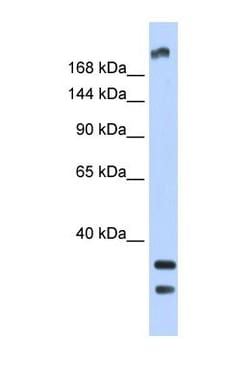 TRPM2 Antibody, Novus Biologicals 0.05mg; Unlabeled:Antibodies, Polyclonal