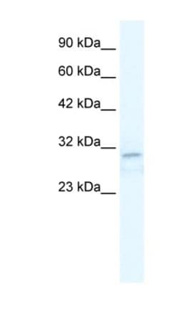 TRPM3 Antibody, Novus Biologicals:Antibodies:Primary Antibodies