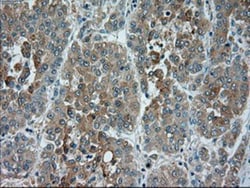 TRPM4 Antibody (OTI10H5), Novus Biologicals 0.1mL; Unlabeled:Antibodies,