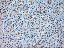 TRPM4 Antibody (OTI10H5), Novus Biologicals 0.1mL; Unlabeled:Antibodies,