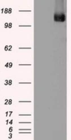 TRPM4 Antibody (OTI10H5), Novus Biologicals 0.1mL; Unlabeled:Antibodies,