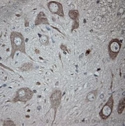 TRPM4 Antibody, Novus Biologicals 0.025 mL | Buy Online | Novus Biologicals | Fisher Scientific