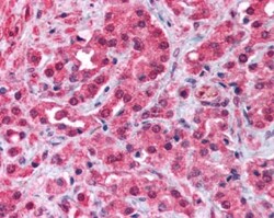 TRPM8 Antibody - BSA Free, Novus Biologicals:Antibodies:Primary Antibodies