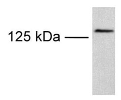 TRPM8 Antibody - BSA Free, Novus Biologicals:Antibodies:Primary Antibodies