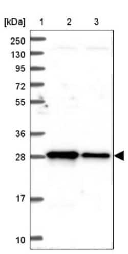 TRPT1 Antibody, Novus Biologicals:Antibodies:Primary Antibodies