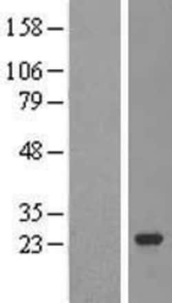 Novus Biologicals&trade;&nbsp;TRPT1 Overexpression Lysate