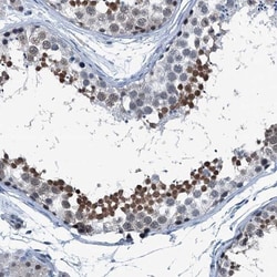 TRPT1 Antibody, Novus Biologicals:Antibodies:Primary Antibodies