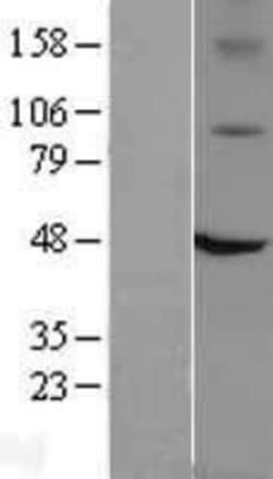Novus Biologicals&trade;&nbsp;Vanilloid R1/TRPV1 Overexpression Lysate