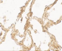 TRPV4 Antibody - BSA Free, Novus Biologicals 0.1mg; Unlabeled:Antibodies,