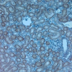 TRPV4 Antibody, Novus Biologicals 0.1 mL; Unconjugated:Antibodies, Polyclonal