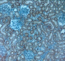 TRPV4 Antibody, Novus Biologicals 0.1 mL; Unconjugated:Antibodies, Polyclonal