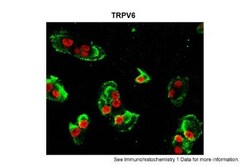 TRPV6 Antibody, Novus Biologicals:Antibodies:Primary Antibodies