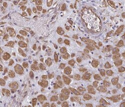 TRPV6 Antibody, Novus Biologicals 25 &mu;L | Buy Online | Novus Biologicals | Fisher Scientific