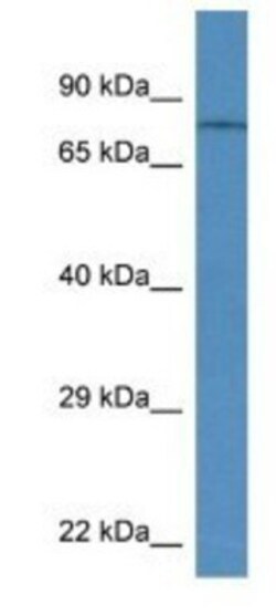 TRPV6 Antibody, Novus Biologicals:Antibodies:Primary Antibodies