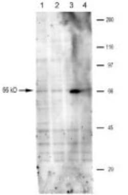 TRPV6 Antibody, Novus Biologicals:Antibodies:Primary Antibodies
