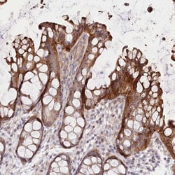 TRUB1 Antibody, Novus Biologicals 25ul | Buy Online | Novus Biologicals | Fisher Scientific