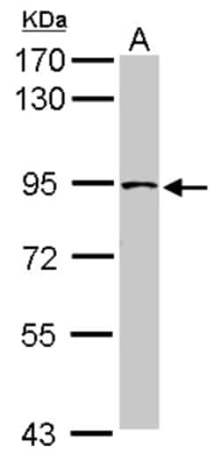 TRUSS Antibody, Novus Biologicals 0.1mL; Unlabeled:Antibodies, Polyclonal