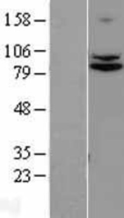 Novus Biologicals™ TRUSS Overexpression Lysate