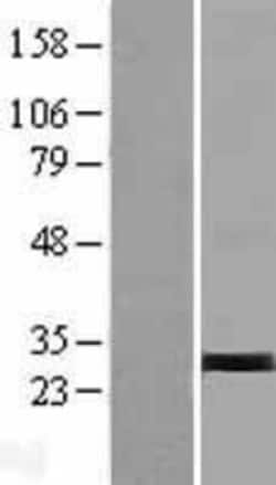 Novus Biologicals™ TRY1 Overexpression Lysate