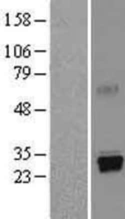 Novus Biologicals&trade;&nbsp;Trypsin 1/PRSS1 Overexpression Lysate