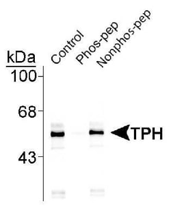 Tryptophan Hydroxylase 1/TPH-1, p Ser260 Antibody, Novus Biologicals 0.1mL;