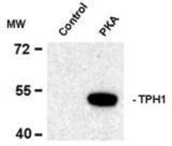 Tryptophan Hydroxylase 1/TPH-1, p Ser58 Antibody, Novus Biologicals 0.1mL;