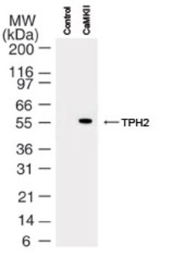 Tryptophan hydroxylase 2 Antibody, Novus Biologicals 0.1mL; Unlabeled:Antibodies,