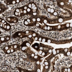Tryptophan rich protein Antibody, Novus Biologicals 0.1mL; Unlabeled:Antibodies,