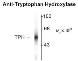 Tryptophan Hydroxylase 1/TPH-1 Antibody, Novus Biologicals 0.1mL; Unlabeled:Antibodies,