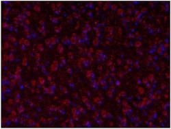Tryptophan hydroxylase 2 Antibody - BSA Free, Novus Biologicals 100 &mu;L | Buy Online | Novus Biologicals | Fisher Scientific