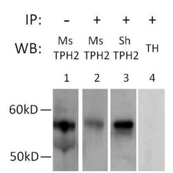 Tryptophan hydroxylase 2 Antibody - BSA Free, Novus Biologicals 100 &mu;L | Buy Online | Novus Biologicals | Fisher Scientific