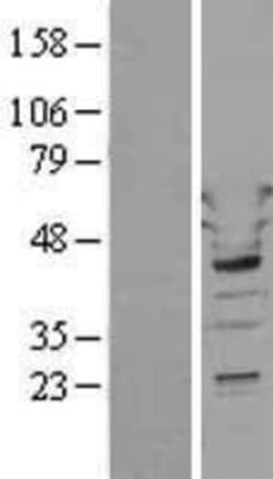 Novus Biologicals™ Tryptophanyl tRNA synthetase Overexpression Lysate