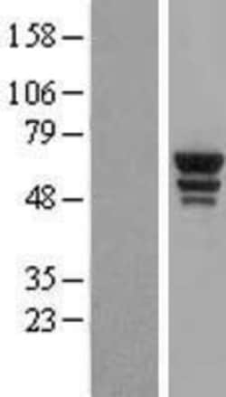 Novus Biologicals™ Tryptophanyl tRNA synthetase Overexpression Lysate