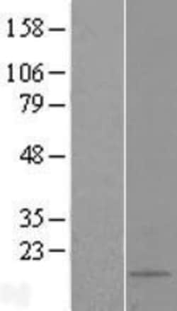 Novus Biologicals™ TSAP19 Overexpression Lysate