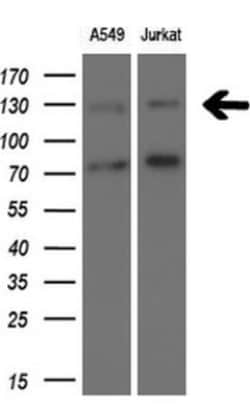 TSC1 Antibody (OTI3A2), Novus Biologicals 0.1mL; Unlabeled:Antibodies,