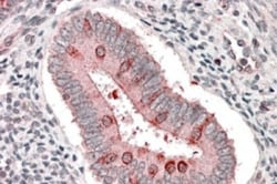 TSC1 Antibody, Novus Biologicals 0.1mg; Unlabeled:Antibodies, Polyclonal
