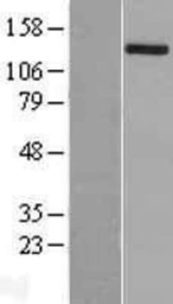 Novus Biologicals&trade;&nbsp;TSC1 Overexpression Lysate