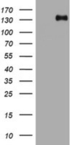 TSC1 Antibody (OTI3A2), Novus Biologicals 0.1mL; Unlabeled:Antibodies,