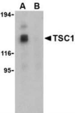 Novus Biologicals&trade;&nbsp;TSC1 Antibody Blocking Peptide