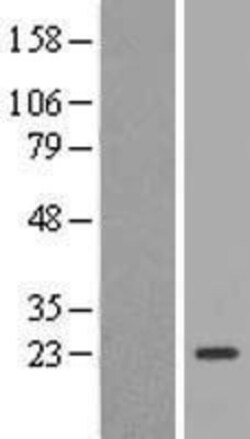 Novus Biologicals&trade;&nbsp;TSC21 Overexpression Lysate