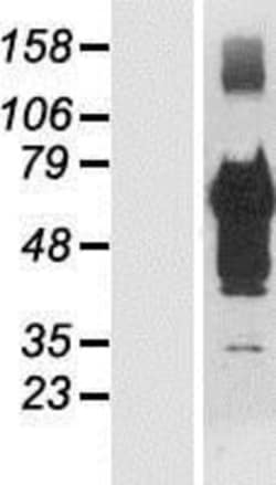 Novus Biologicals&trade;&nbsp;TSC22D4 Overexpression Lysate