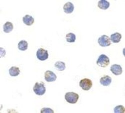 TSC2 Antibody - BSA Free, Novus Biologicals 0.025 mg, Unconjugated:Antibodies,