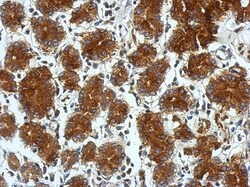 TSCOT Antibody, Novus Biologicals 0.1mL; Unlabeled:Antibodies, Polyclonal