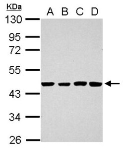 TSCOT Antibody, Novus Biologicals 0.1mL; Unlabeled:Antibodies, Polyclonal