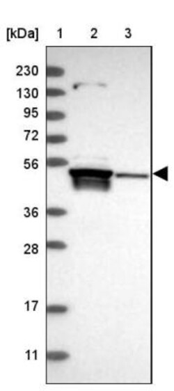 TSEN2 Antibody, Novus Biologicals:Antibodies:Primary Antibodies