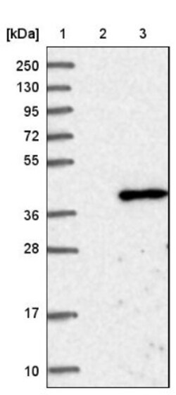 TSEN34 Antibody, Novus Biologicals:Antibodies:Primary Antibodies