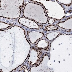 TSEN34 Antibody, Novus Biologicals:Antibodies:Primary Antibodies